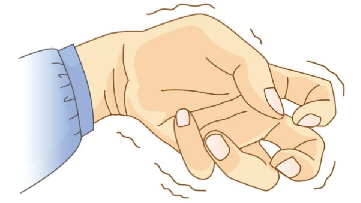 女人癫痫是什么原因