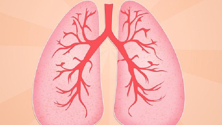关于肺气肿的常识介绍