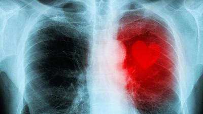 肺气肿的症状都有哪些呢