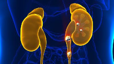 肾病综合症疾病能治好吗