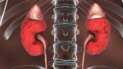 肾病综合征的日常饮食要注意什么