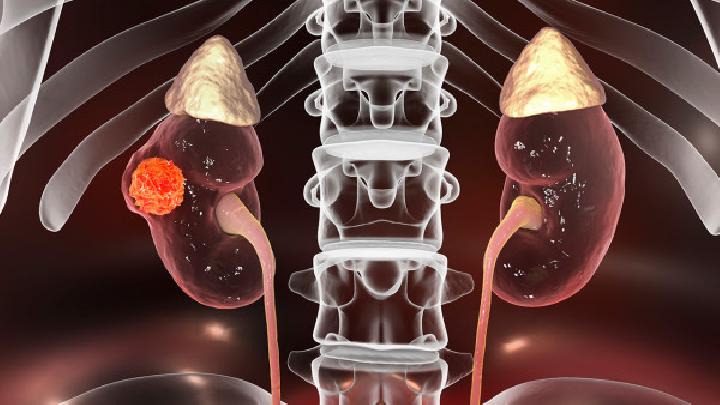 慢性腎盂腎炎的治療方法