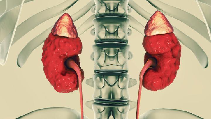 科学用药及时可治疗多囊肾