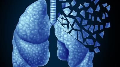 肺纤维化有哪些临床症状