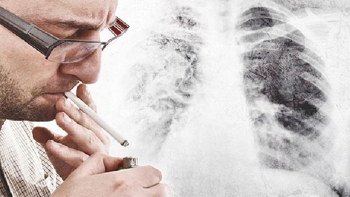 男性得了肺炎可以吸烟吗