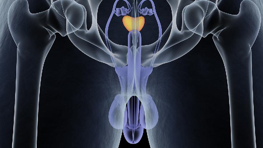 良性前列腺增生治疗方法有哪些 3个良性前列腺增生的治疗方法