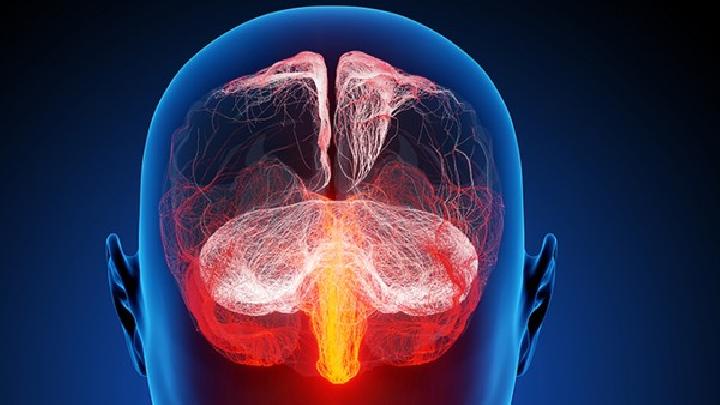 痙攣性腦癱治療方法