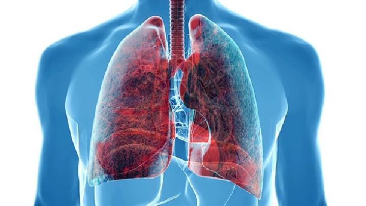 慢阻肺的症状是什么