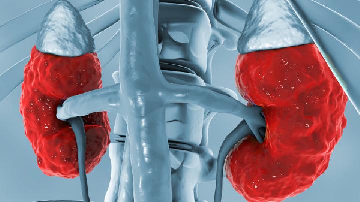 腎盂腎炎治療費用高嗎