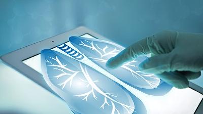 肺纤维化常见治疗方法