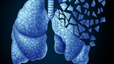 肺纤维化会遗传给小孩吗