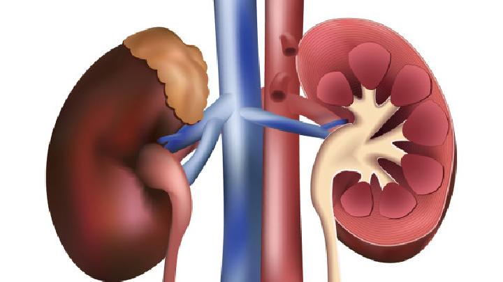 原發(fā)性腎盂腎炎的常見癥狀