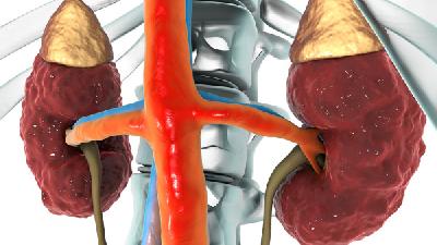 什么原因会导致肾病综合征