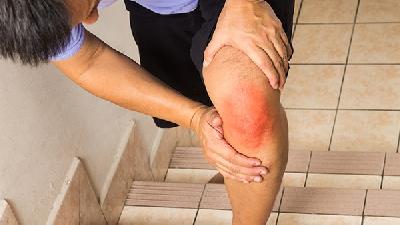 中药熏洗可治疗膝关节滑膜炎