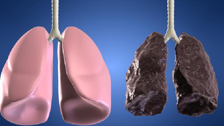 慢阻肺的发病病因有哪些