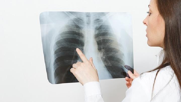 慢阻肺症状表现为哪些