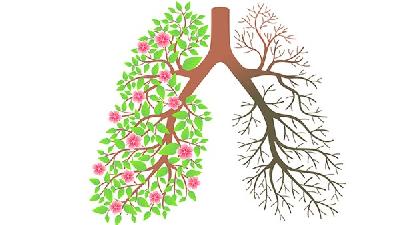 肺气肿如何合理用药