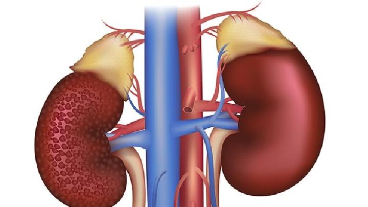 治療多囊腎的藥方