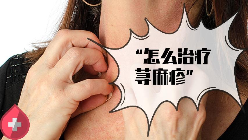 專治蕁麻疹的好藥品