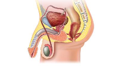 哪些因素可以导致前列腺反复充血 3因素导致前列腺反复充血