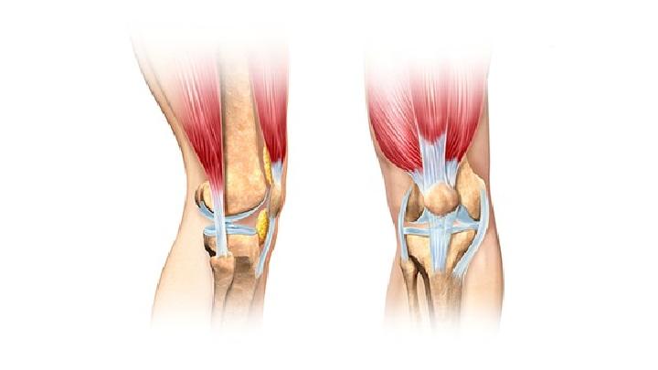 膝关节炎的病因病理