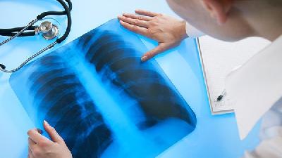 得肺纤维化中期的症状是什么
