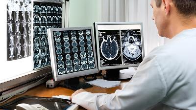 脑癌检查方法有几种