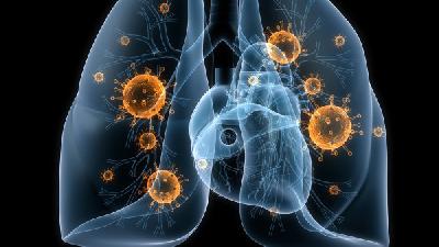 一般肺癌怎么检查出来