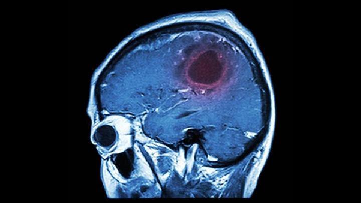 预防脑癌早期的方法