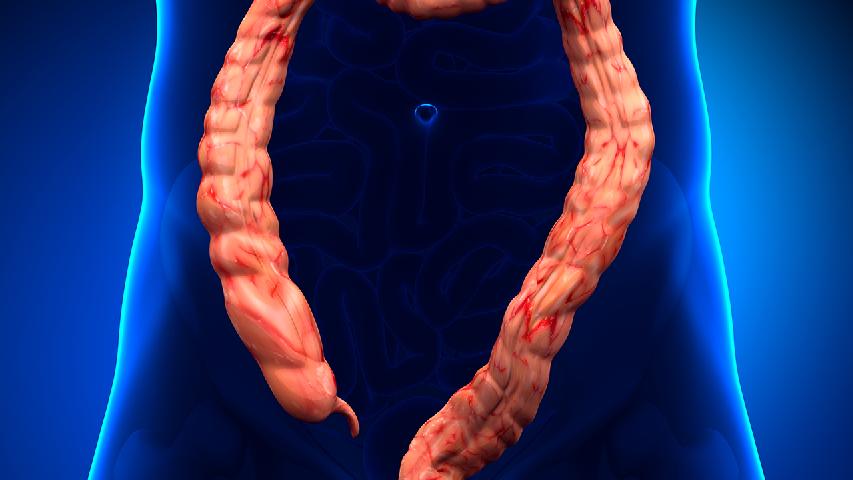 直肠息肉有哪些常见症状