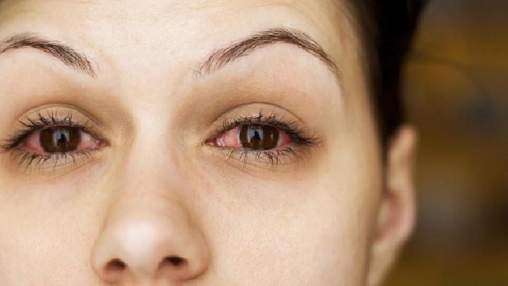 与红眼病患者对视会不会传染