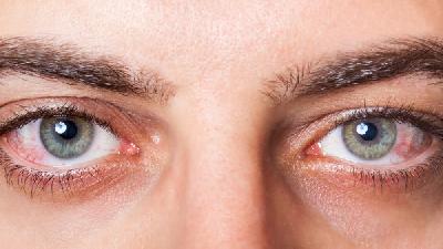 哪些原因导致人们患上红眼病