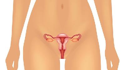 子宫内膜异位症注意事项有哪些