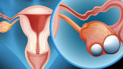 哪家医院治疗子宫内膜异位症好