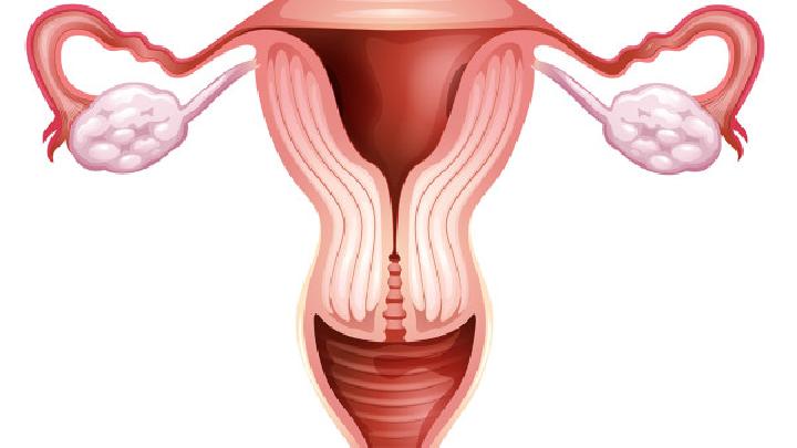 宫颈纳氏囊肿在饮食方面有什么需要
