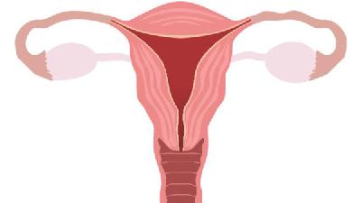 女性应该怎样预防子宫内膜厚