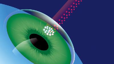 改善视觉环境对眼结石预防有帮助吗