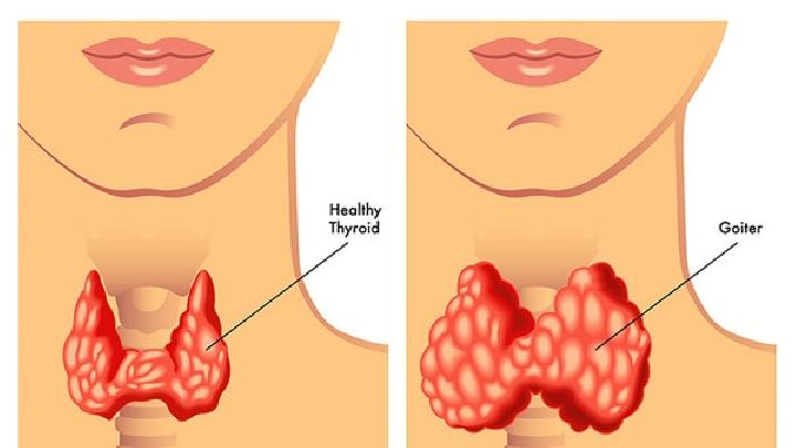 儿童出现流行性腮腺炎父母们怎么做呢？