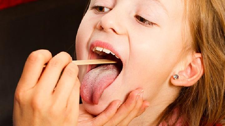 女性舌癌患者的症状表现