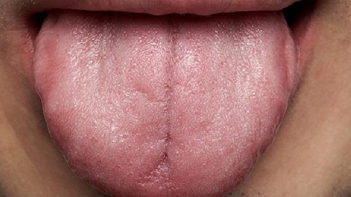 舌癌转移后的症状是什么