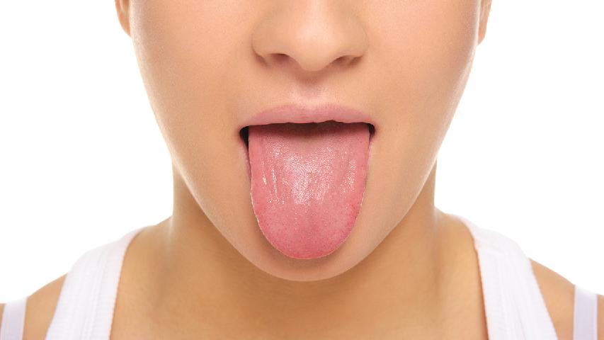 浸润型舌癌症状呢