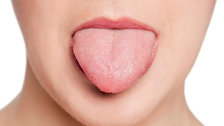 舌癌主要症状表现是什么