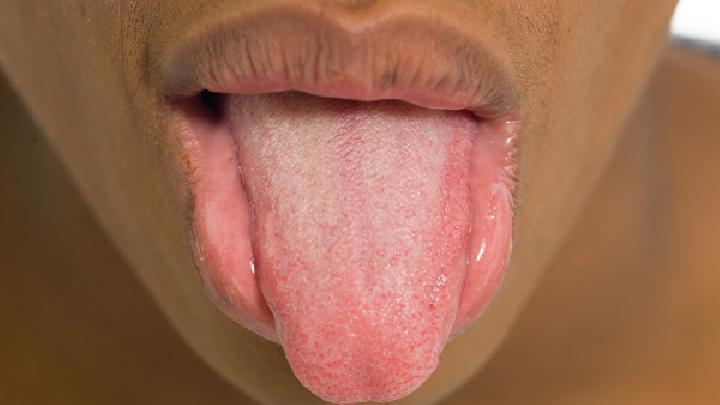 小孩舌癌什么症状？