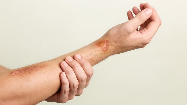 营养不良能确诊吗