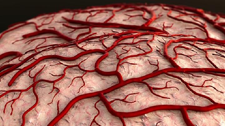 具体了解下脑供血不足发病的原因