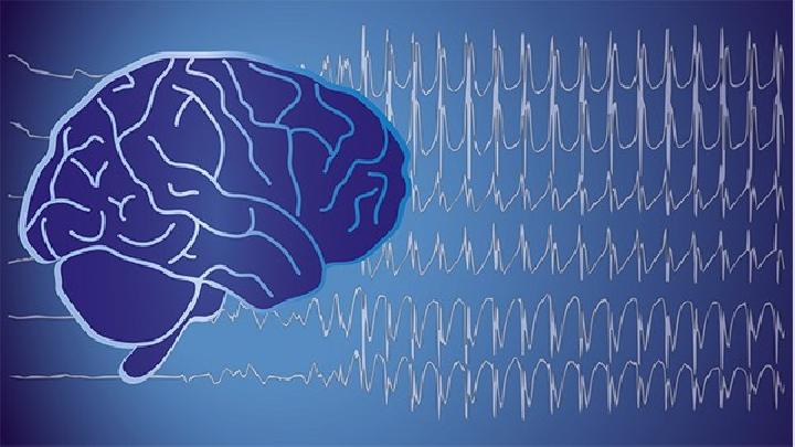 脑血管痉挛常用的五种检查指标