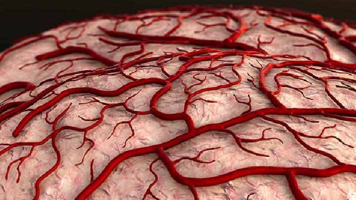 针对脑血管痉挛病因综述