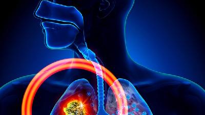 几种典型的肺栓塞症状