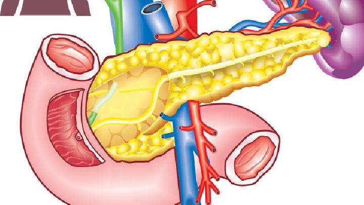 肝内胆管结石三大护理方法