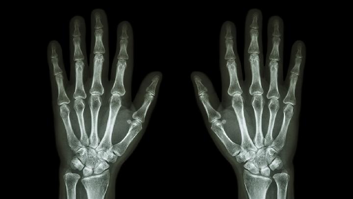 肋软骨炎有效的护理方法